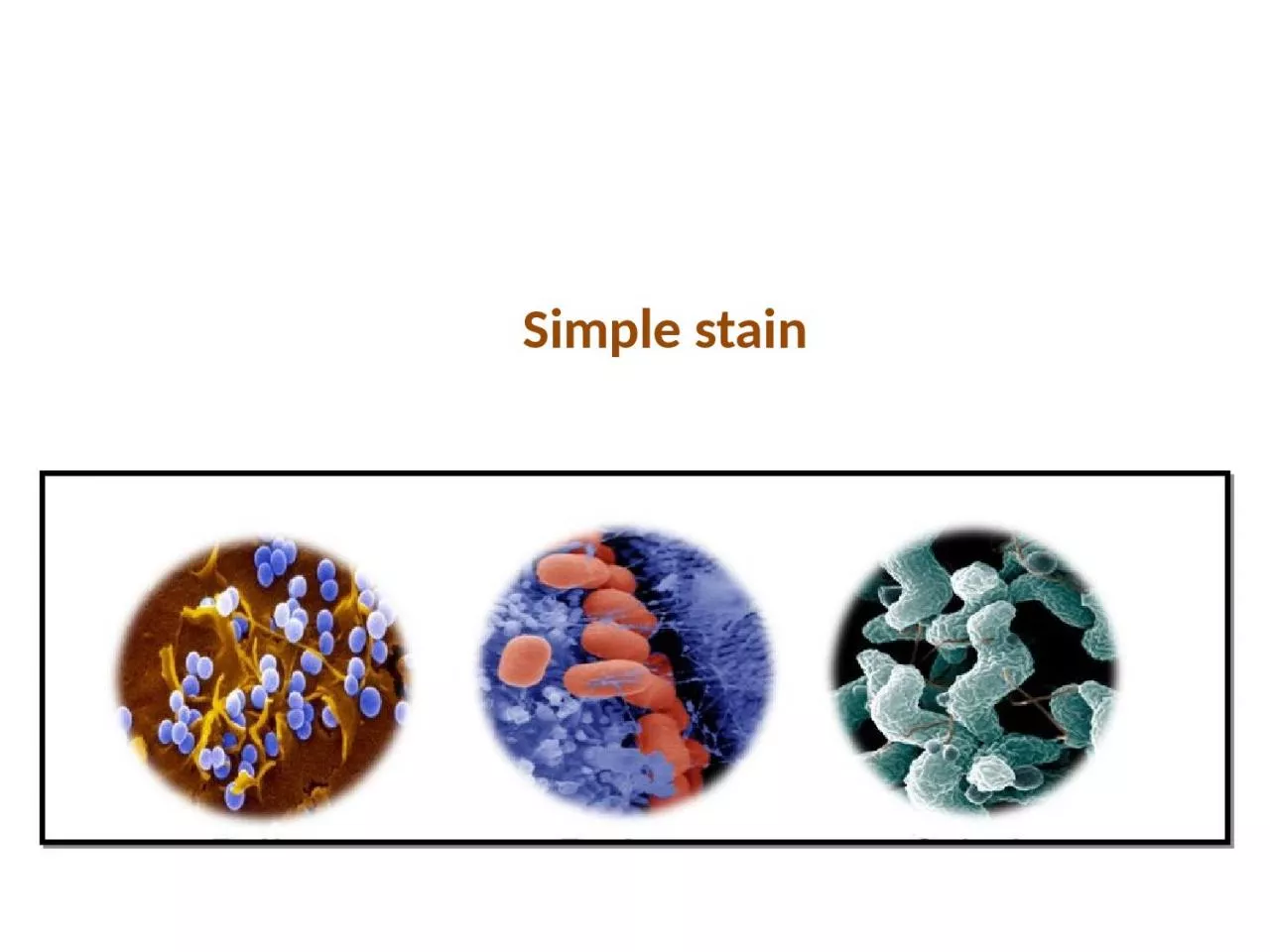 Simple stain Bacterial Morphology