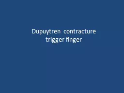 Dupuytren  contracture trigger finger