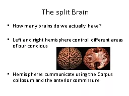 The split Brain  How   many