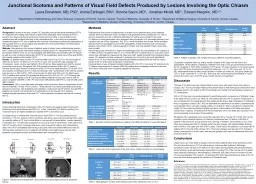 Junctional Scotoma and Patterns of Visual Field Defects Produced by Lesions Involving the Optic Chi