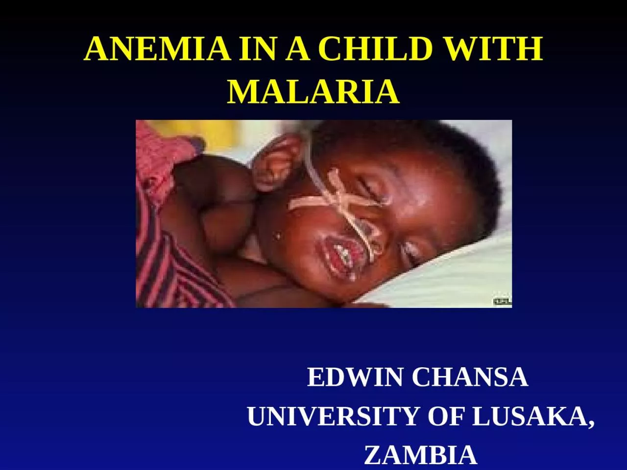 PPT-ANEMIA IN A CHILD WITH MALARIA