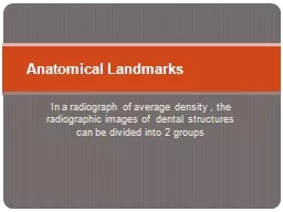 In a radiograph of average density , the radiographic images of  dental structures can be divided