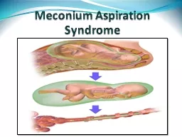 Meconium Aspiration Syndrome