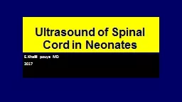 Ultrasound of Spinal Cord in Neonates