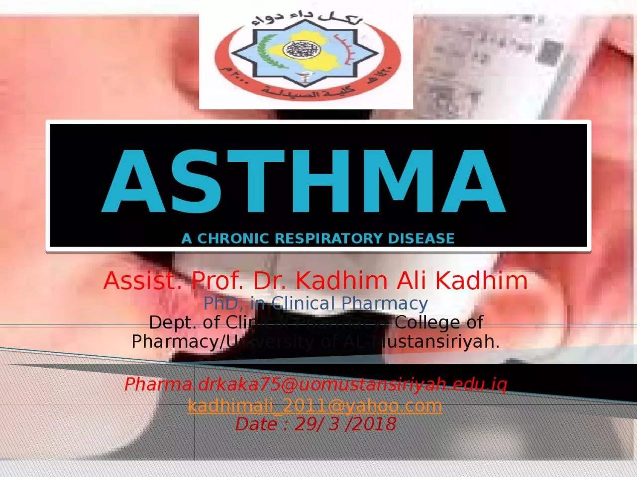 ASTHMA  A CHRONIC RESPIRATORY DISEASE