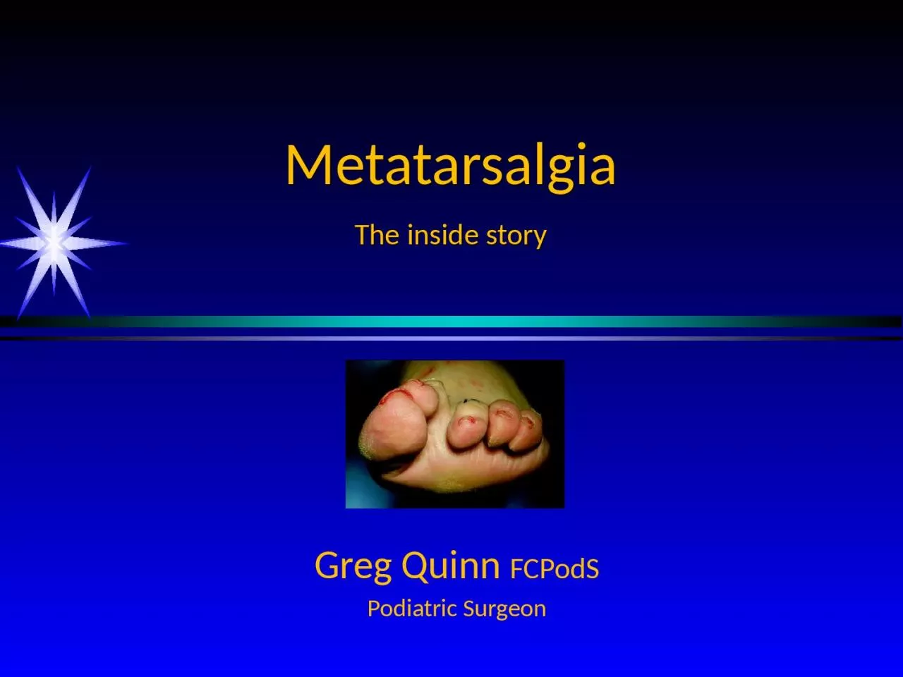 PPT-Metatarsalgia The inside story