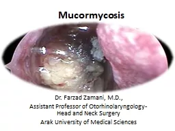 Mucormycosis Dr.  Farzad