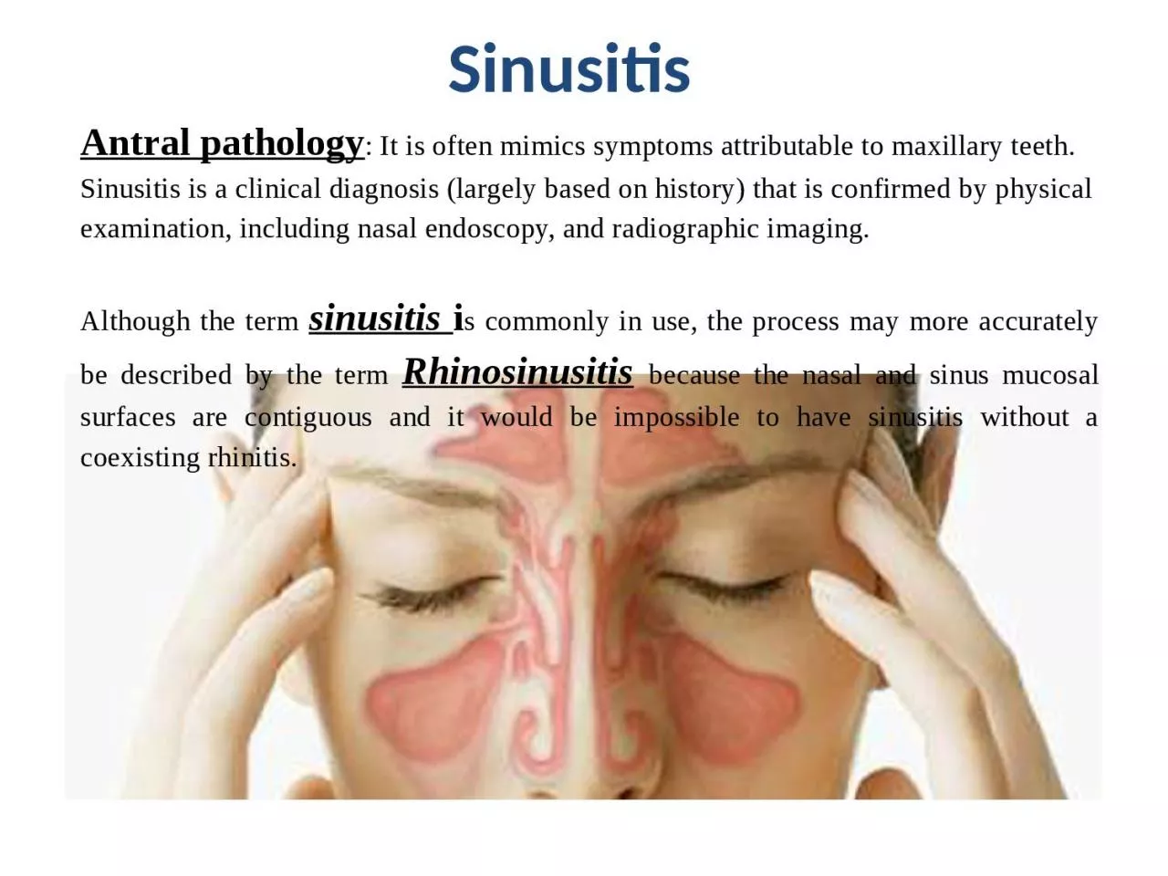Sinusitis   	 - bed rest, nasal decongestants, analgesics, antibiotics