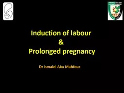 Induction of labour &