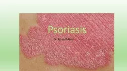 Psoriasis Dr. M.  Arif