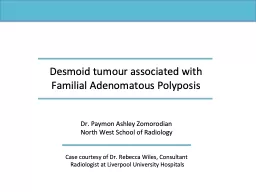 Desmoid   t umour  associated with