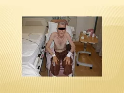 Tripod Breathing:  Patients with advanced lung disease (in this case COPD) will often assume a trip