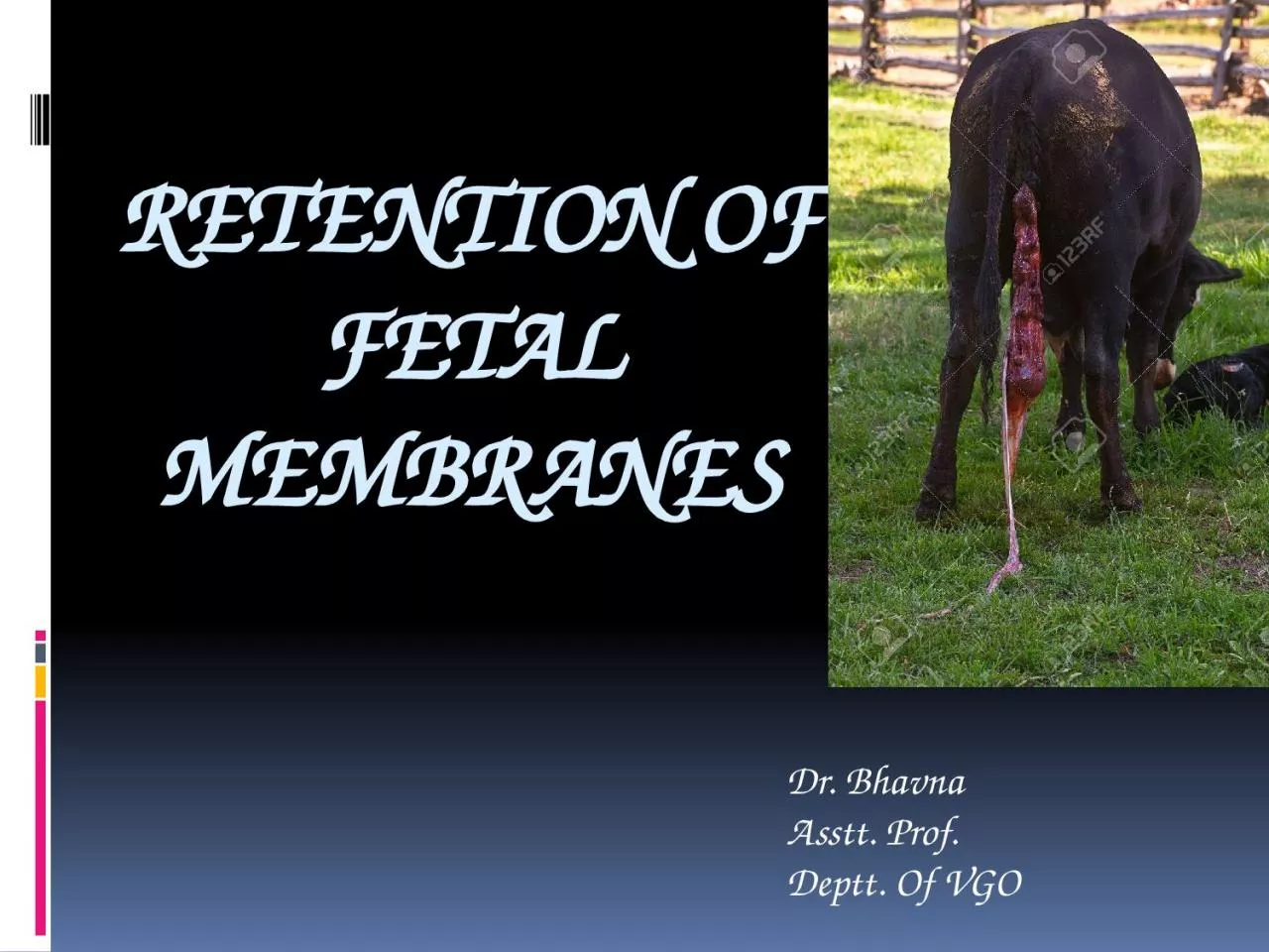 PPT-Retention of fetal Membranes