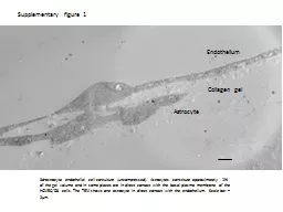 Supplementary figure 1 3d-astrocyte endothelial cell co-culture (uncompressed). Astrocytes constitu