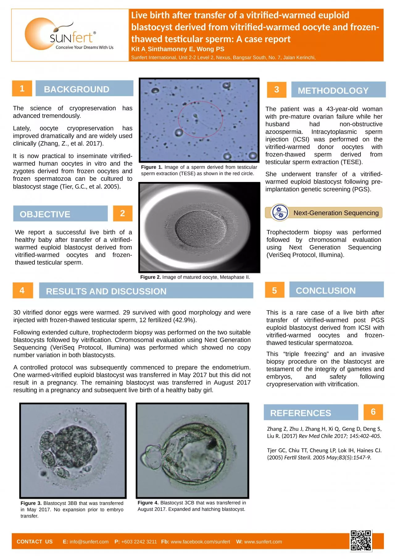 PPT-Live birth after transfer of a vitrified-warmed euploid blastocyst derived from vitrified-warmed