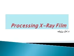 Processing X-Ray Film