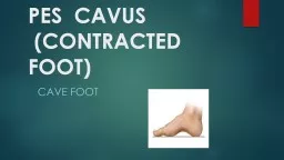 PES  CAVUS  (CONTRACTED FOOT)