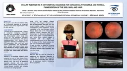 OCULAR ALBINISM AS A DIFFERENTIAL DIAGNOSIS FOR CONGENITAL NYSTAGMUS AND NORMAL PIGMENTATION OF THE