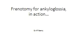 Frenotomy for  ankyloglossia