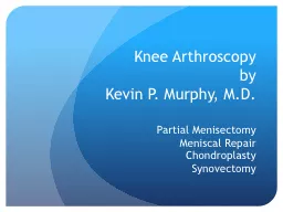 Knee Arthroscopy by  Kevin P. Murphy, M.D.