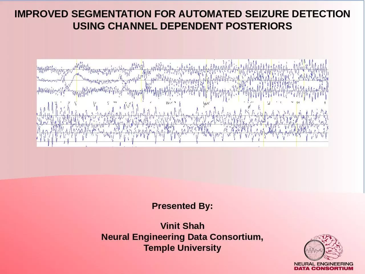 Improved Segmentation for Automated Seizure Detection
