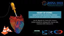 HEART OF STONE:  DESMYSTIFYING INCIDENTAL CARDIAC CALCIFICATION ON COMPUTED TOMOGRAPHY