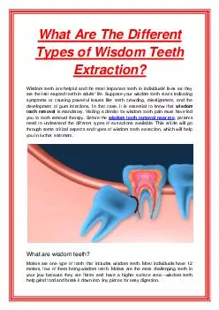 What Are The Different Types of Wisdom Teeth Extraction?