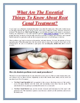 What Are The Essential Things To Know About Root Canal Treatment?