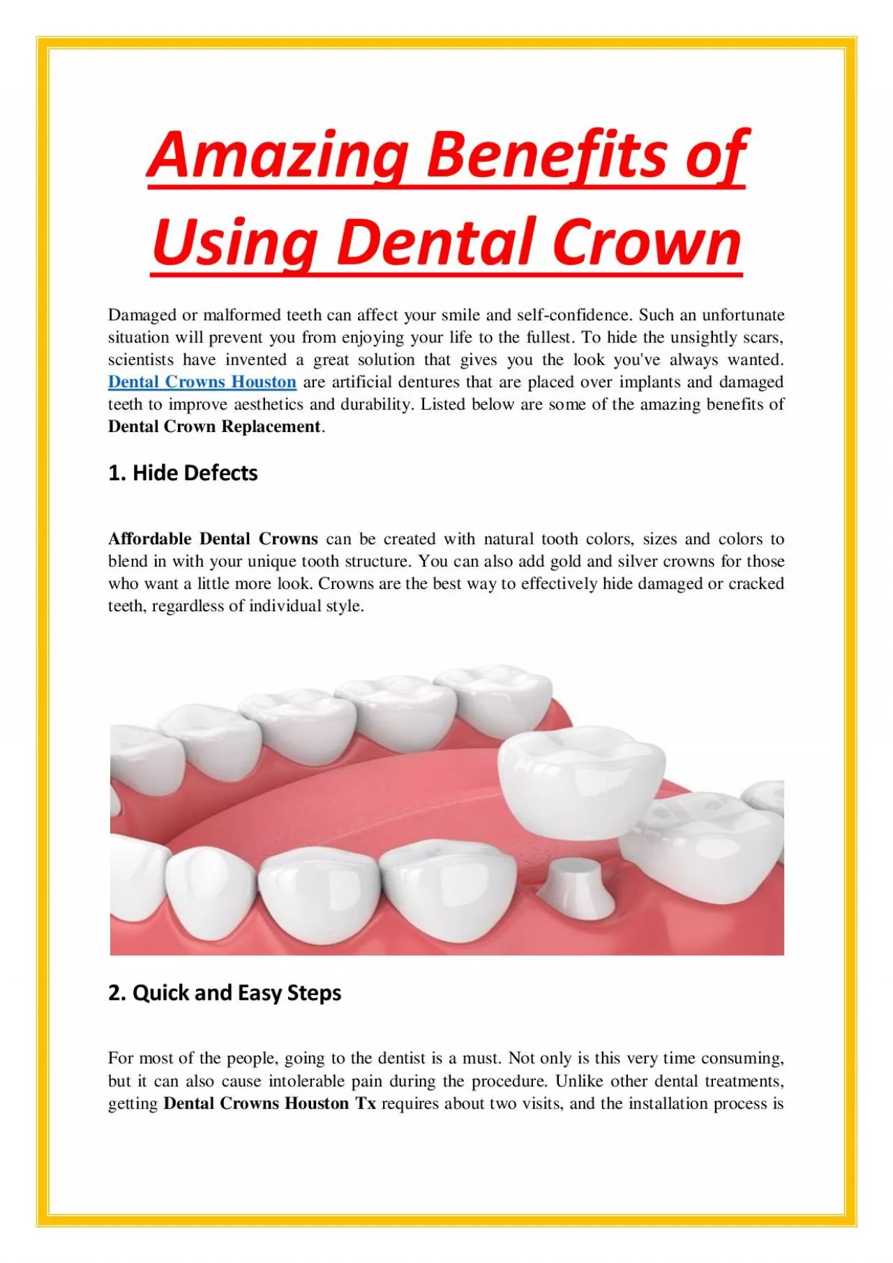 Amazing Benefits of Using Dental Crown