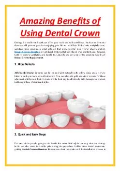 Amazing Benefits of Using Dental Crown