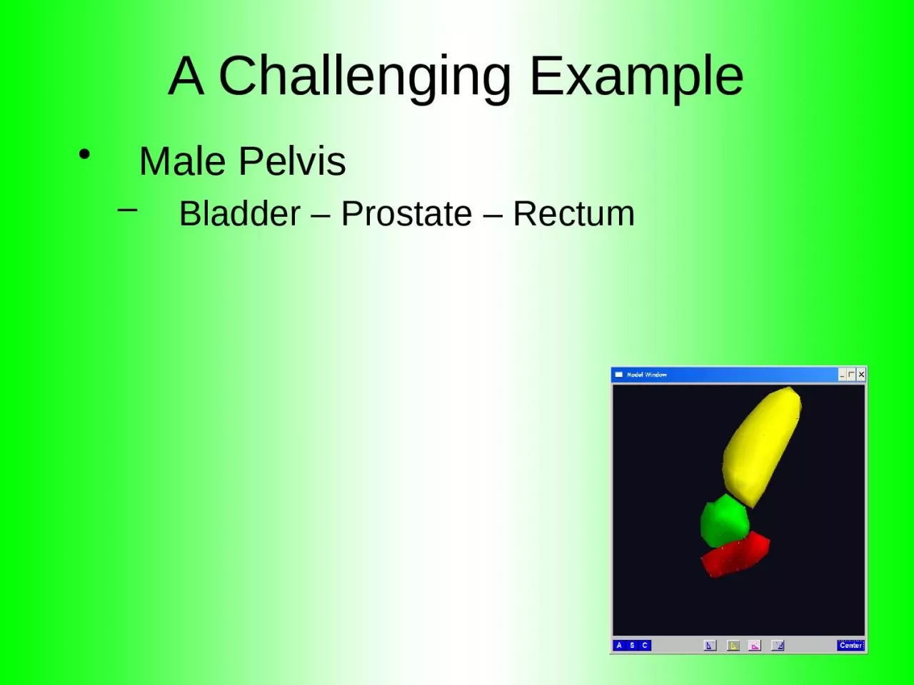 PPT-A Challenging Example Male Pelvis