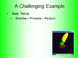 A Challenging Example Male Pelvis