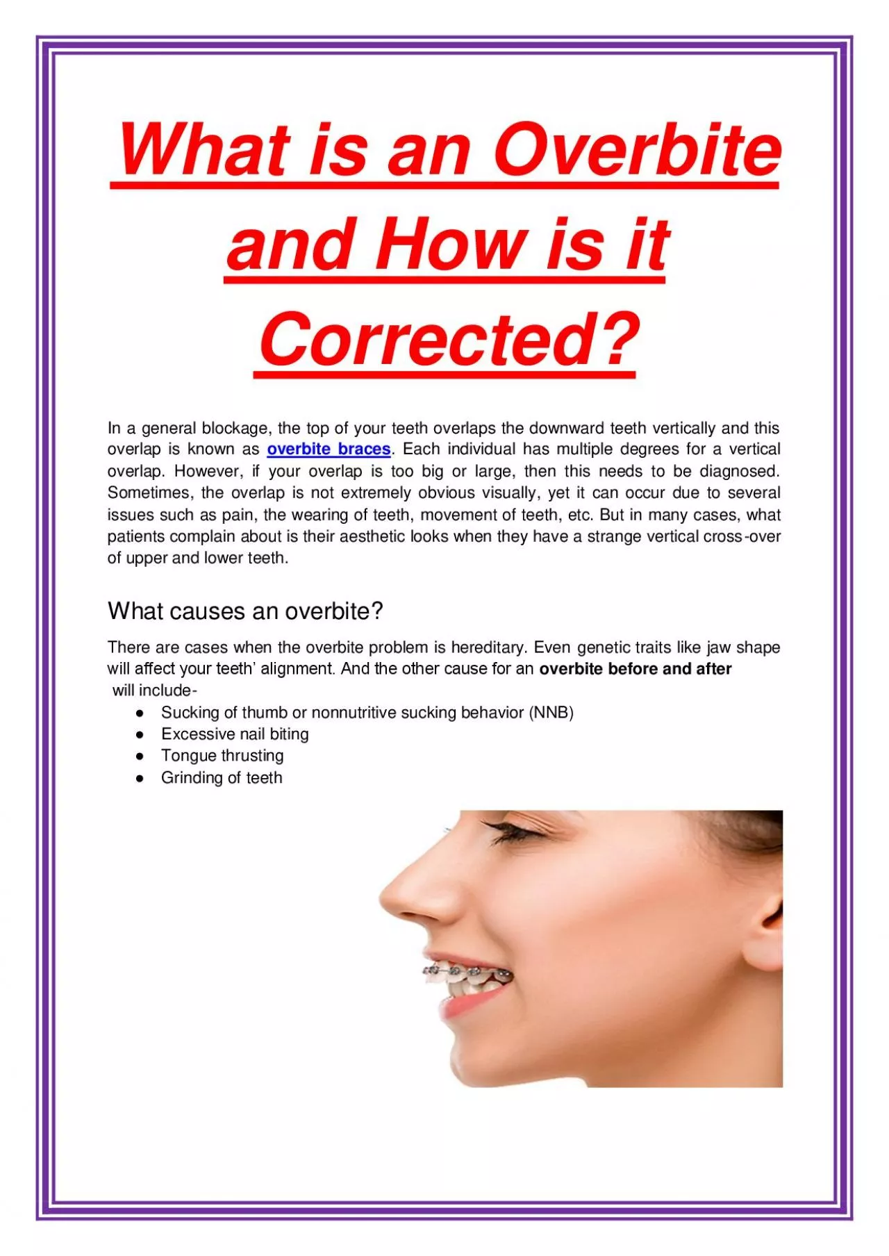 What is an Overbite and How is it Corrected?