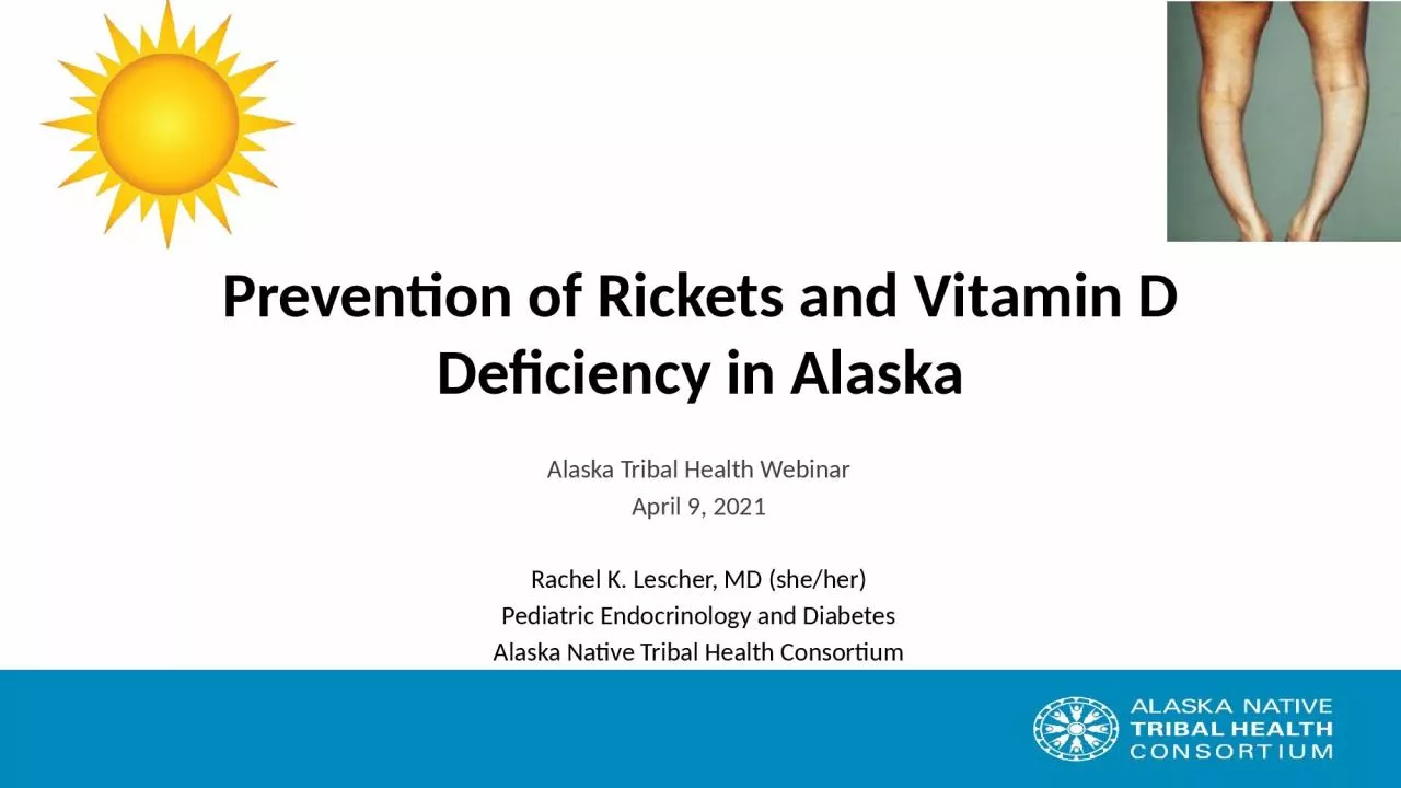 PPT-Prevention of Rickets and Vitamin D Deficiency in Alaska