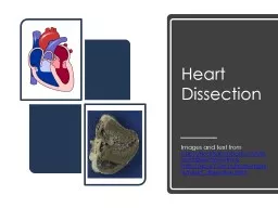 Heart Dissection Images and text from