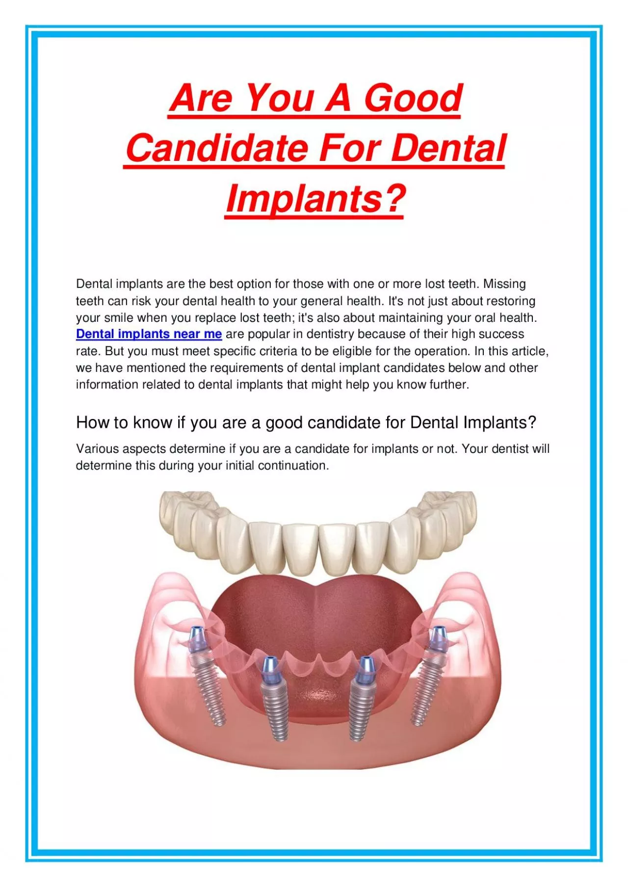 PDF-Are You A Good Candidate For Dental Implants?