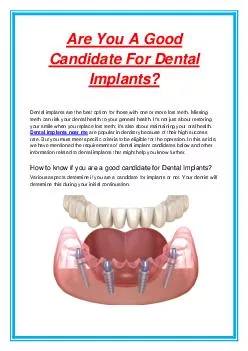 Are You A Good Candidate For Dental Implants?