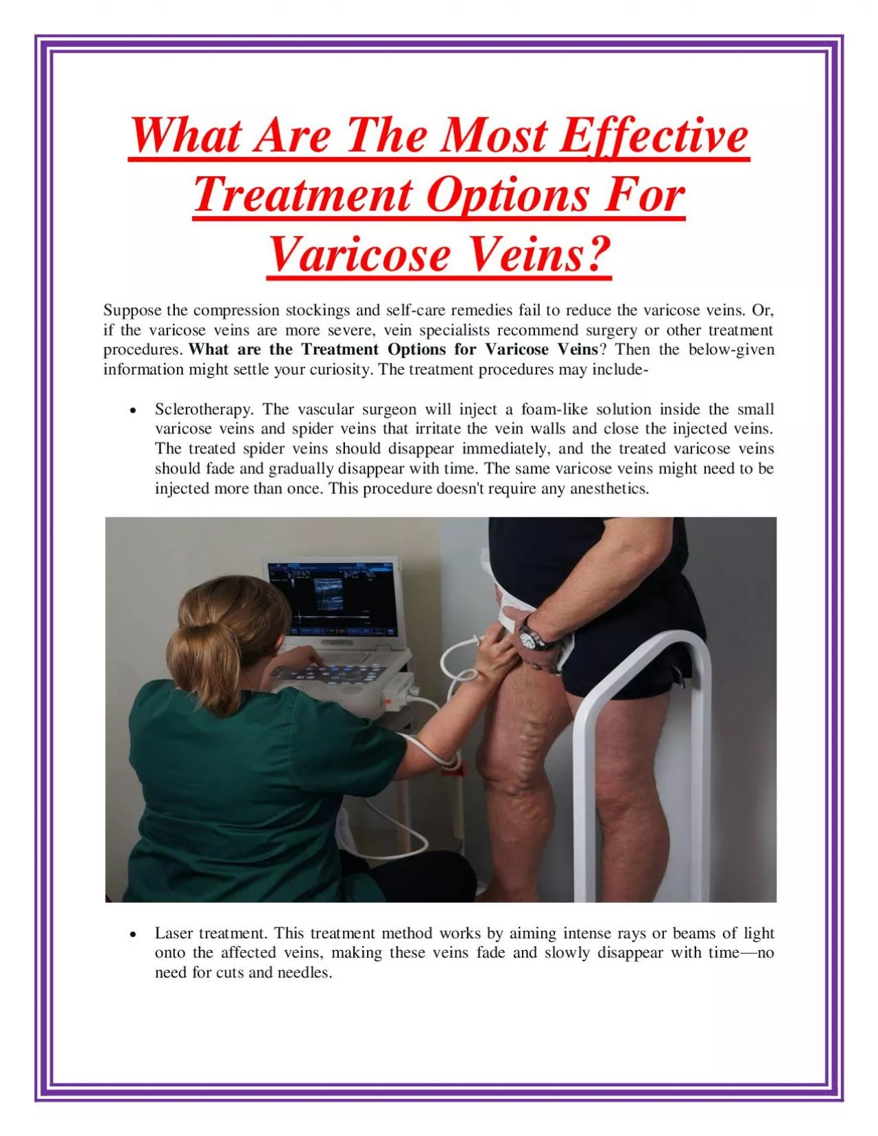 What Are The Most Effective Treatment Options For Varicose Veins?
