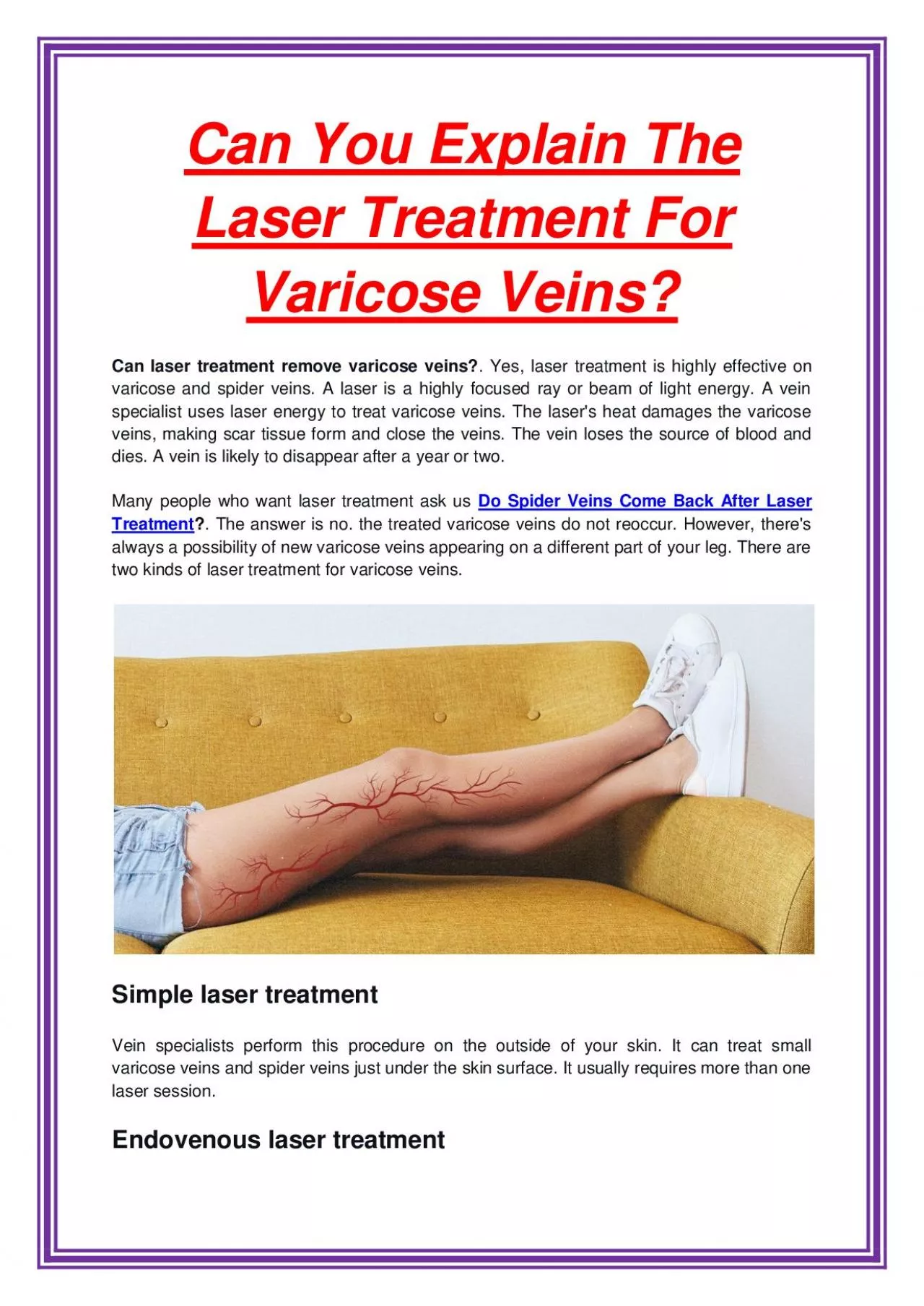 Can You Explain The Laser Treatment For Varicose Veins?
