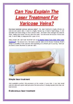 Can You Explain The Laser Treatment For Varicose Veins?