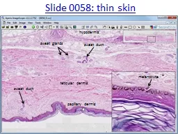 Slide 0058: thin skin reticular dermis