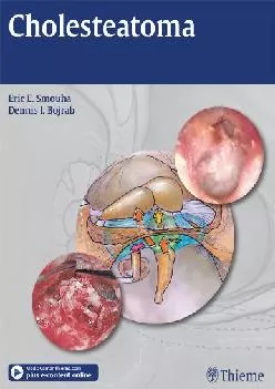 (EBOOK)-Cholesteatoma