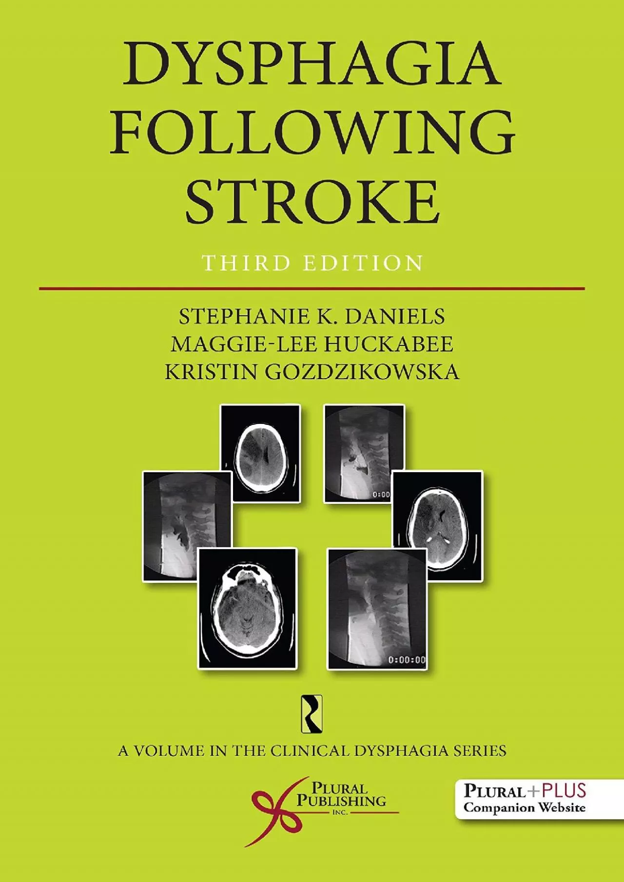 PDF-(DOWNLOAD)-Dysphagia Following Stroke (Clinical Dysphagia)