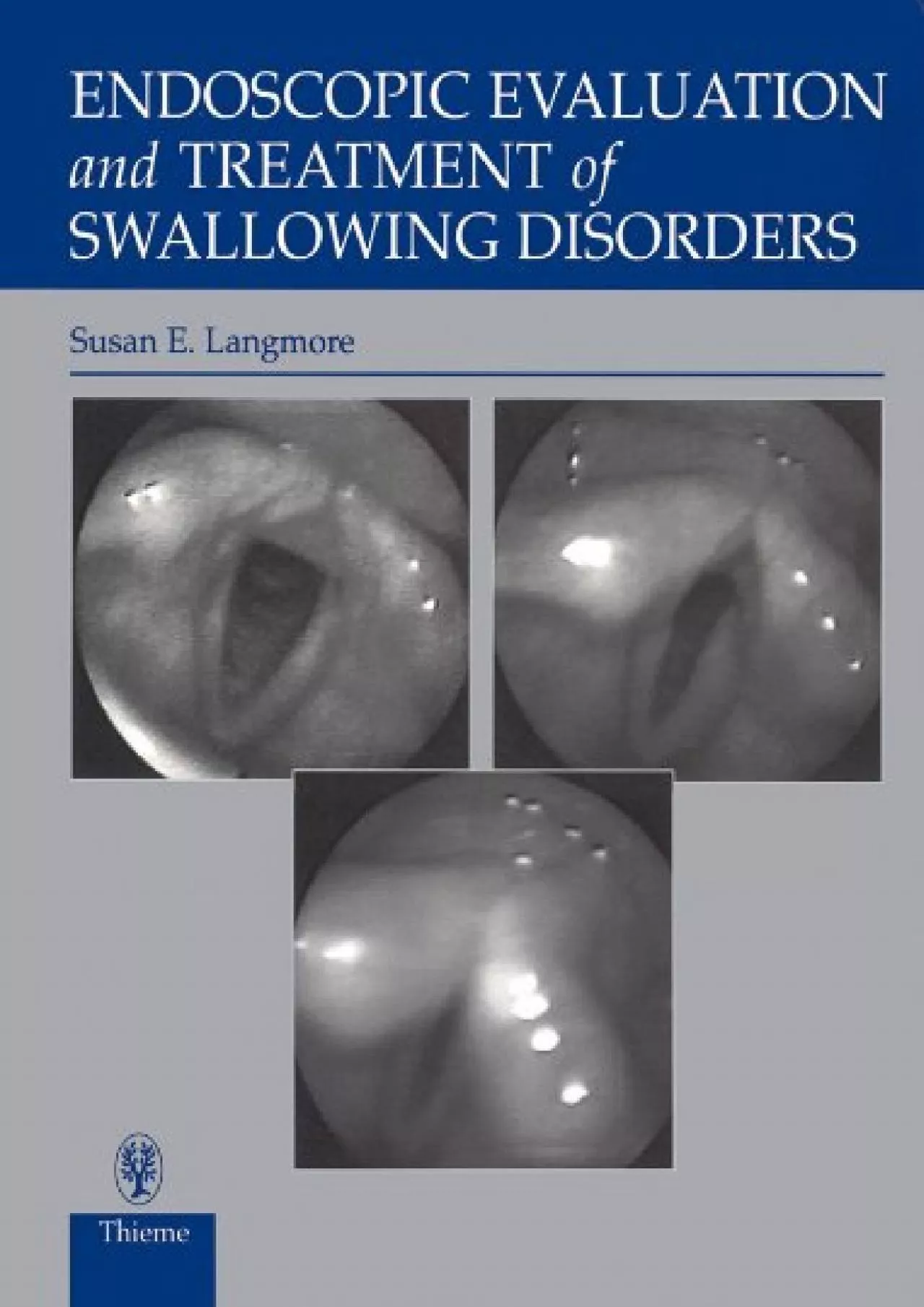 (EBOOK)-Endoscopic Evaluation and Treatment of Swallowing Disorders