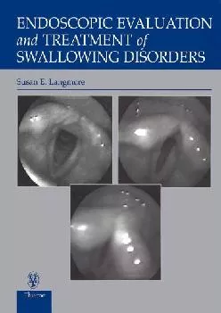 (DOWNLOAD)-Endoscopic Evaluation and Treatment of Swallowing Disorders