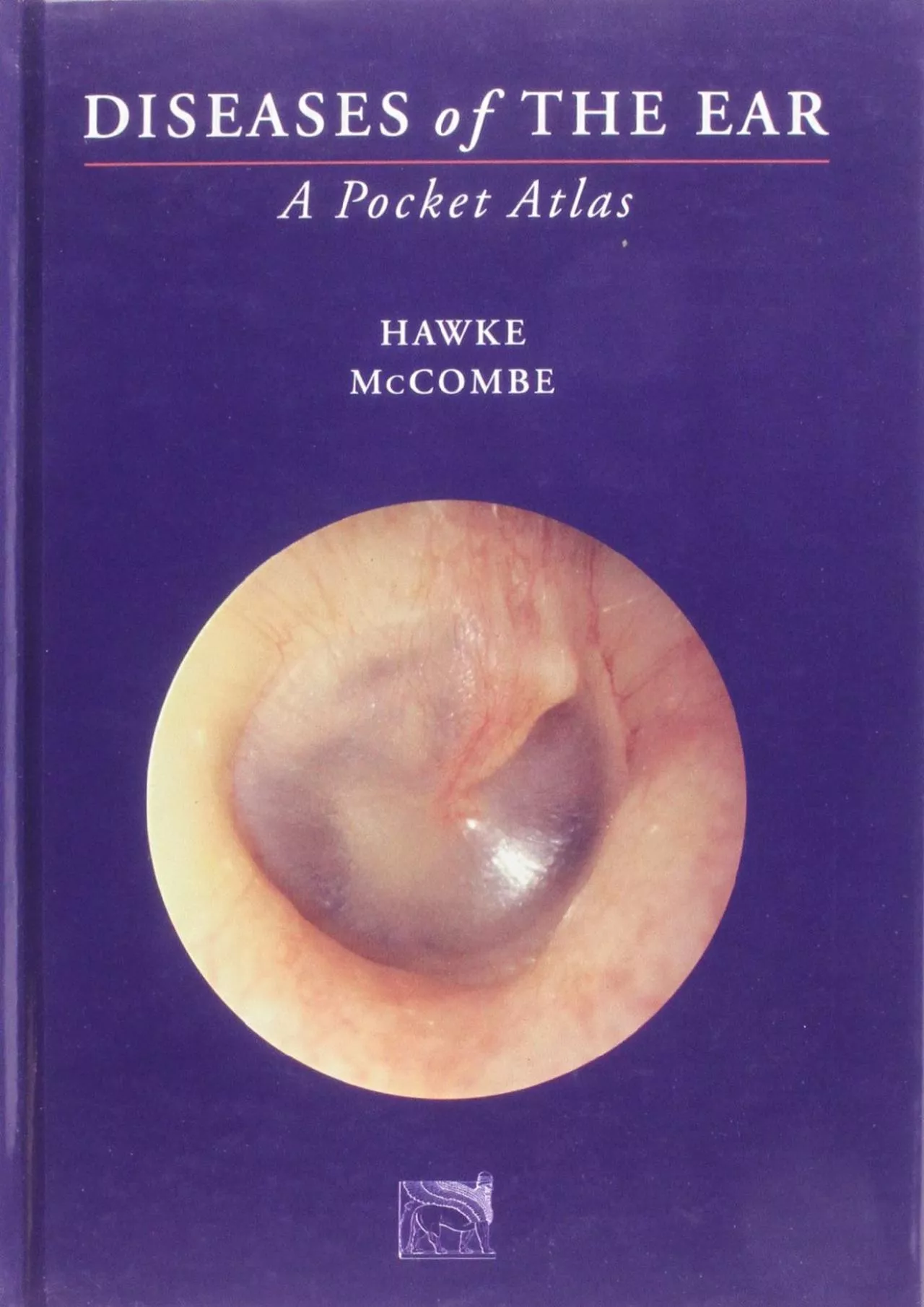 PDF-(BOOK)-Diseases of the Ear: A Pocket Atlas