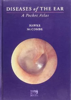 (BOOK)-Diseases of the Ear: A Pocket Atlas