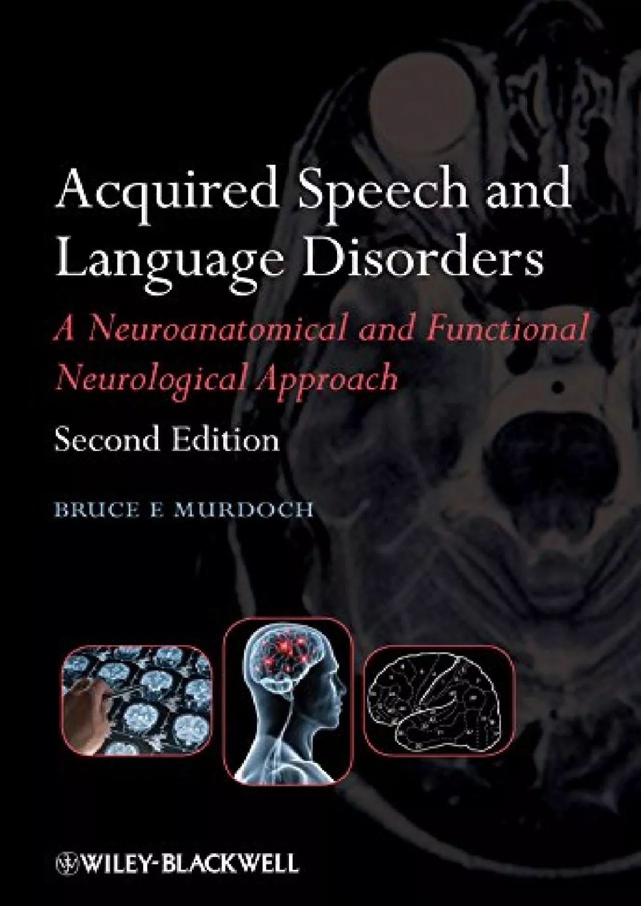 PDF-(DOWNLOAD)-Acquired Speech and Language Disorders