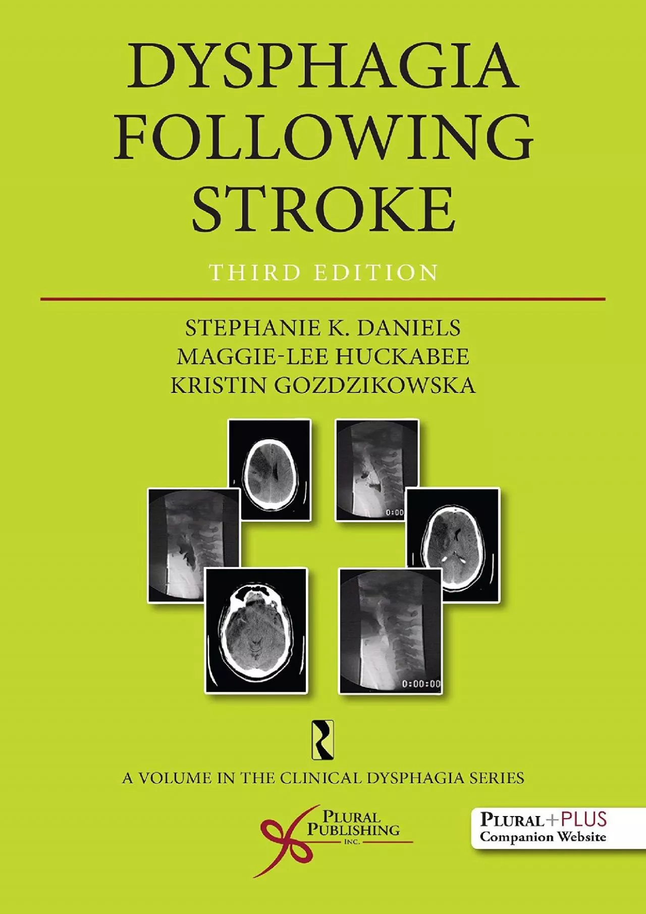 (BOOK)-Dysphagia Following Stroke (Clinical Dysphagia)