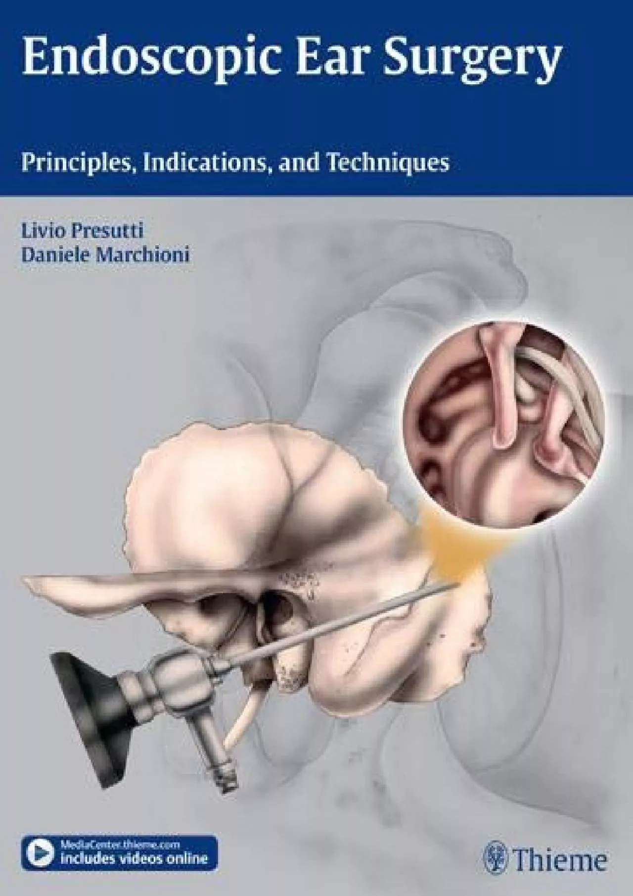 PDF-(BOOK)-Endoscopic Ear Surgery: Principles, Indications, and Techniques